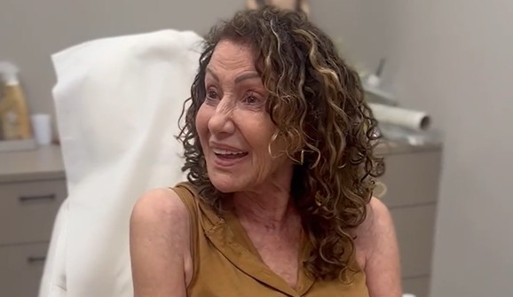 מטופלת מעניקה חוות דעת על טיפול נימים אצל ד"ר רודניצקי